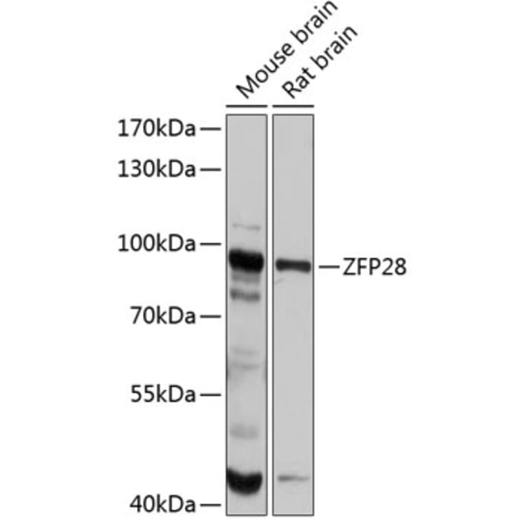 Western Blot - Anti-ZFP28 Antibody (A80971) - Antibodies.com