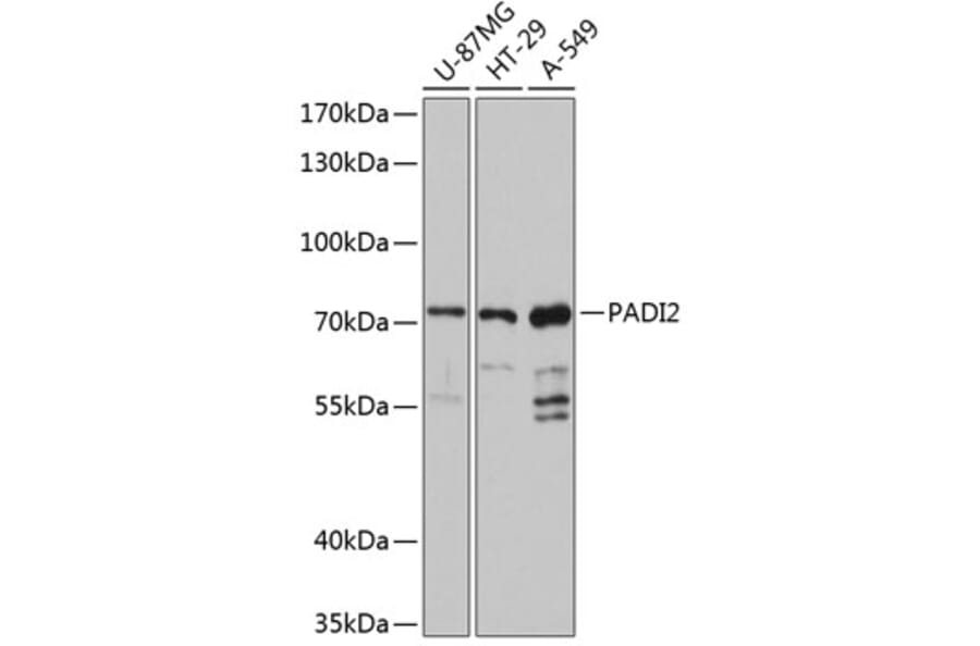 Western Blot - Anti-PADI2/PAD2 Antibody (A80972) - Antibodies.com