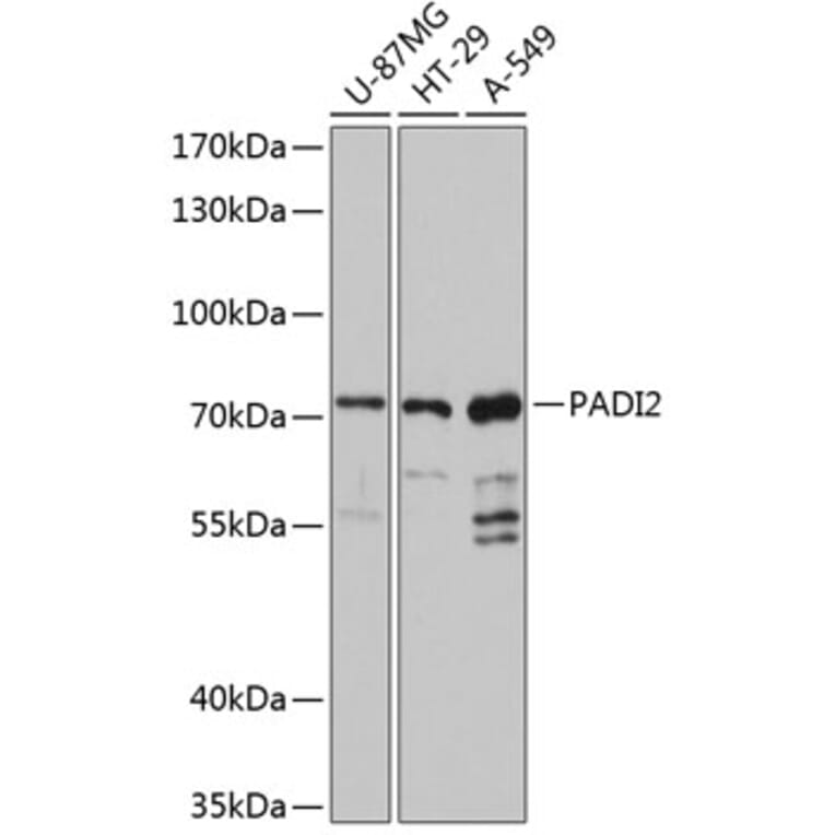 Western Blot - Anti-PADI2/PAD2 Antibody (A80972) - Antibodies.com