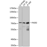 Western Blot - Anti-PADI2/PAD2 Antibody (A80972) - Antibodies.com