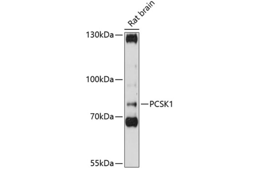 Western Blot - Anti-PC1/3 Antibody (A80973) - Antibodies.com