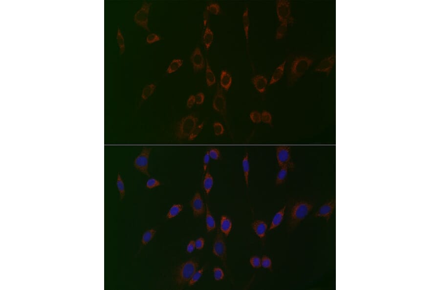 Immunofluorescence - Anti-PC1/3 Antibody (A80973) - Antibodies.com