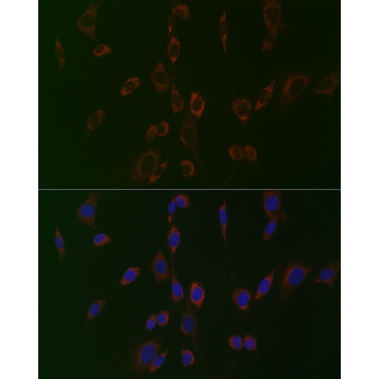 Immunofluorescence - Anti-PC1/3 Antibody (A80973) - Antibodies.com