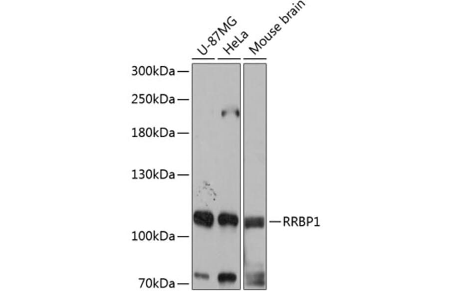 Western Blot - Anti-RRBP1 Antibody (A80974) - Antibodies.com