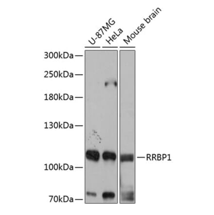 Western Blot - Anti-RRBP1 Antibody (A80974) - Antibodies.com