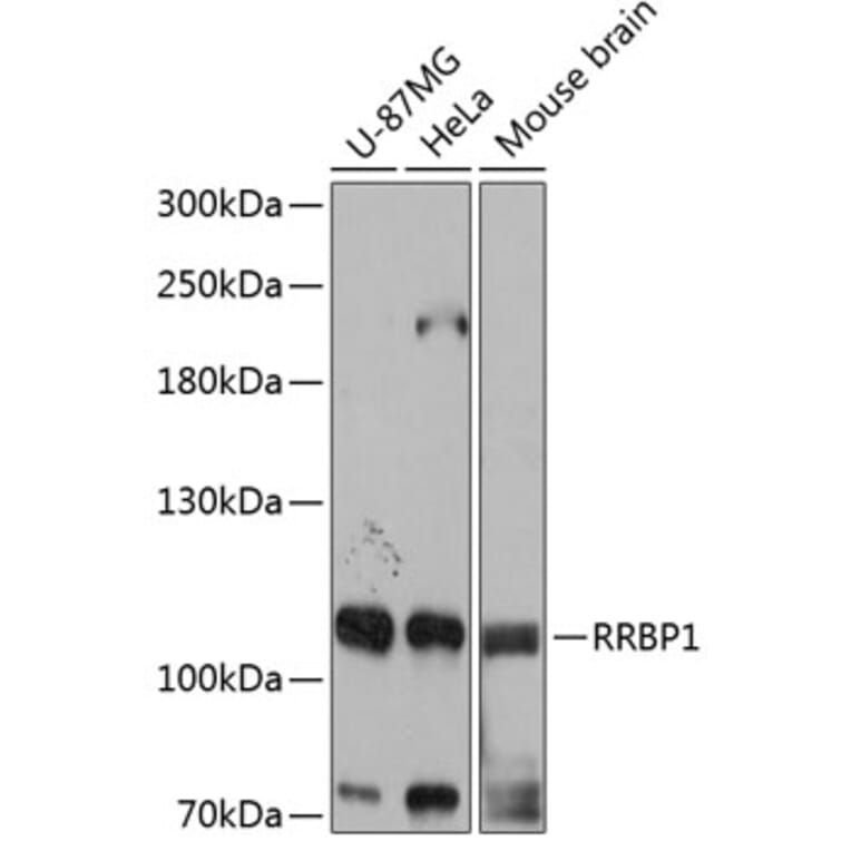 Western Blot - Anti-RRBP1 Antibody (A80974) - Antibodies.com