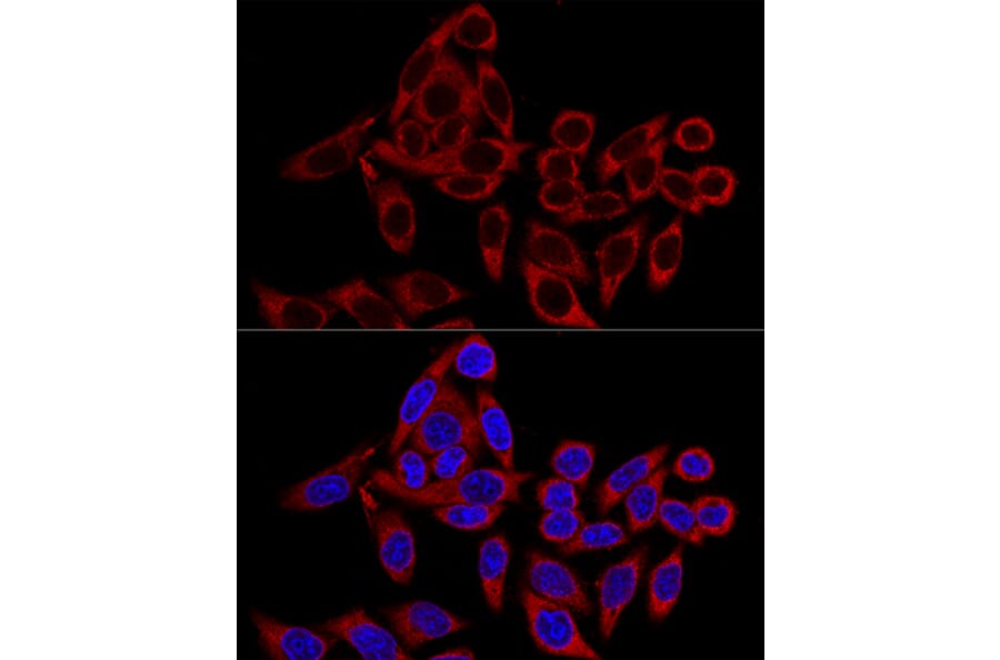 Immunofluorescence - Anti-RRBP1 Antibody (A80974) - Antibodies.com