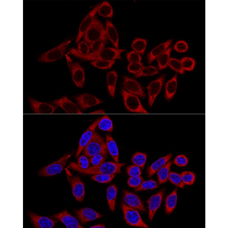 Immunofluorescence - Anti-RRBP1 Antibody (A80974) - Antibodies.com