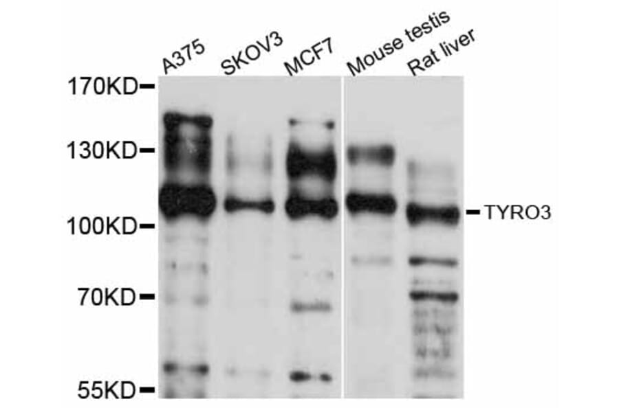 Western Blot - Anti-TYRO3 Antibody (A12241) - Antibodies.com