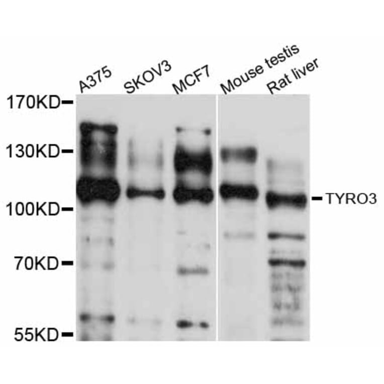 Western Blot - Anti-TYRO3 Antibody (A12241) - Antibodies.com