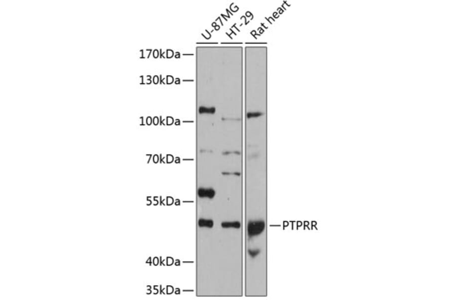 Western Blot - Anti-PCPTP1/PTPRQ Antibody (A80977) - Antibodies.com