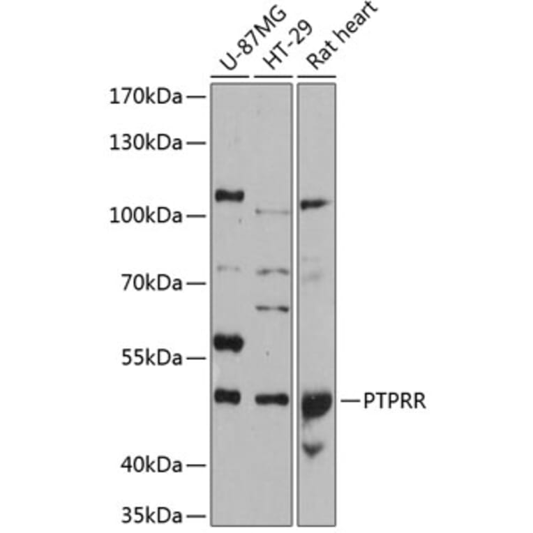 Western Blot - Anti-PCPTP1/PTPRQ Antibody (A80977) - Antibodies.com