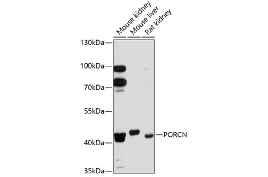 Western Blot - Anti-PORCN/PPN Antibody (A80978) - Antibodies.com