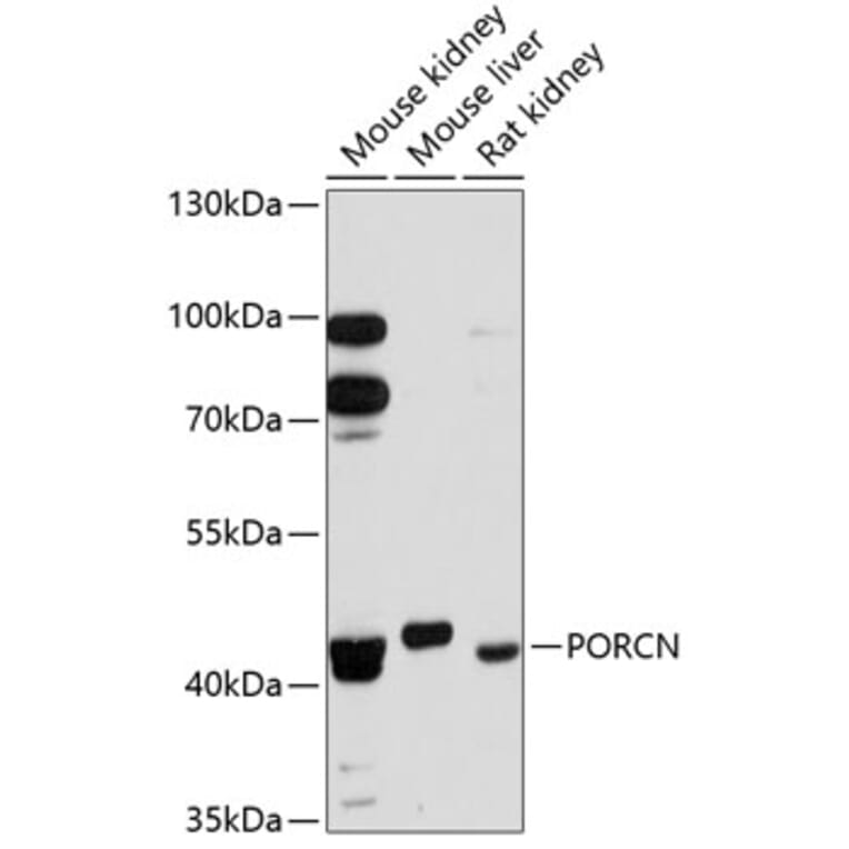 Western Blot - Anti-PORCN/PPN Antibody (A80978) - Antibodies.com