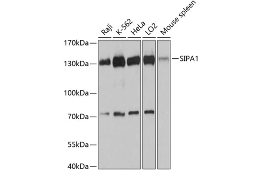 Western Blot - Anti-Spa-1 Antibody (A80980) - Antibodies.com