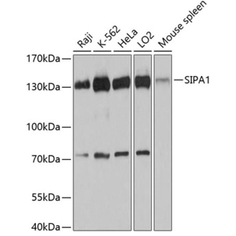 Western Blot - Anti-Spa-1 Antibody (A80980) - Antibodies.com