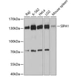 Western Blot - Anti-Spa-1 Antibody (A80980) - Antibodies.com