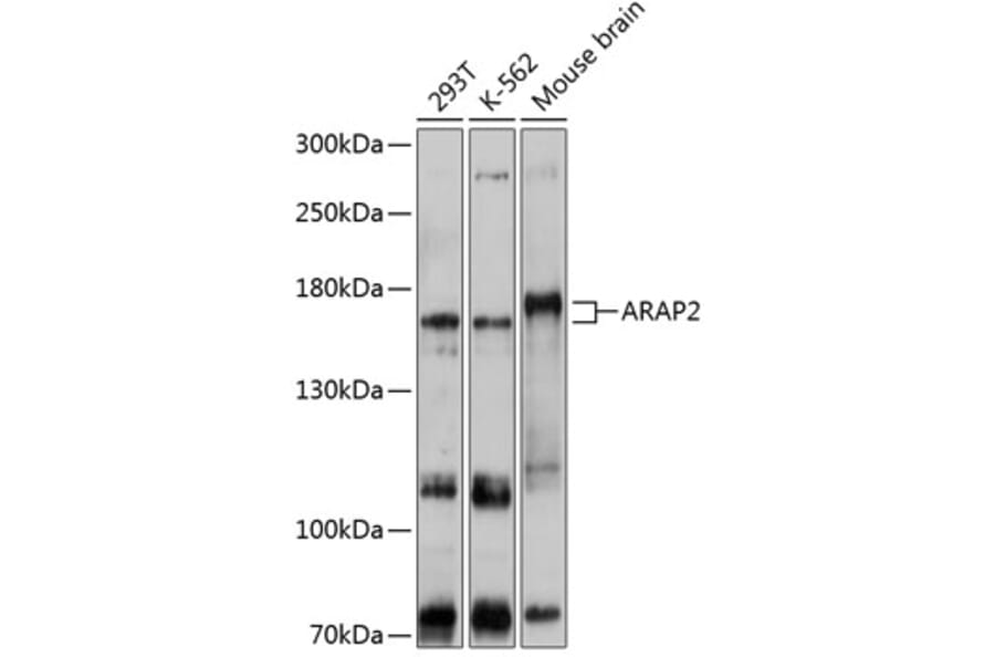 Western Blot - Anti-ARAP2 Antibody (A80981) - Antibodies.com