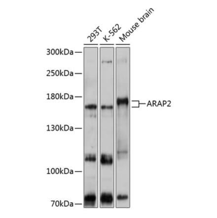 Western Blot - Anti-ARAP2 Antibody (A80981) - Antibodies.com
