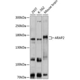 Western Blot - Anti-ARAP2 Antibody (A80981) - Antibodies.com