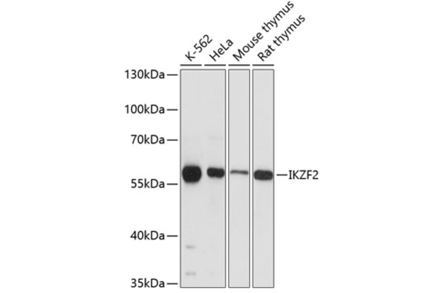 Western Blot - Anti-ZNFN1A2/HELIOS Antibody (A80982) - Antibodies.com