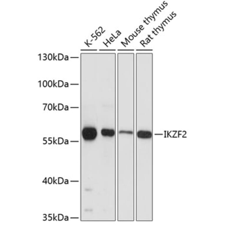 Western Blot - Anti-ZNFN1A2/HELIOS Antibody (A80982) - Antibodies.com