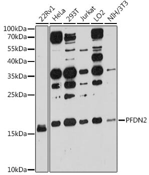 Western blot analysis of extracts of various cell lines, using Anti-PFDN2 Antibody (A12269) at 1:3000 dilution.
Secondary antibody: Goat Anti-Rabbit IgG (H+L) (HRP) (AS014) at 1:10,000 dilution.
Lysates / proteins: 25µg per lane.
Blocking buffer: 3% non-fat dry milk in TBST.
Detection: ECL Basic Kit (RM00020).
Exposure time: 90s.
