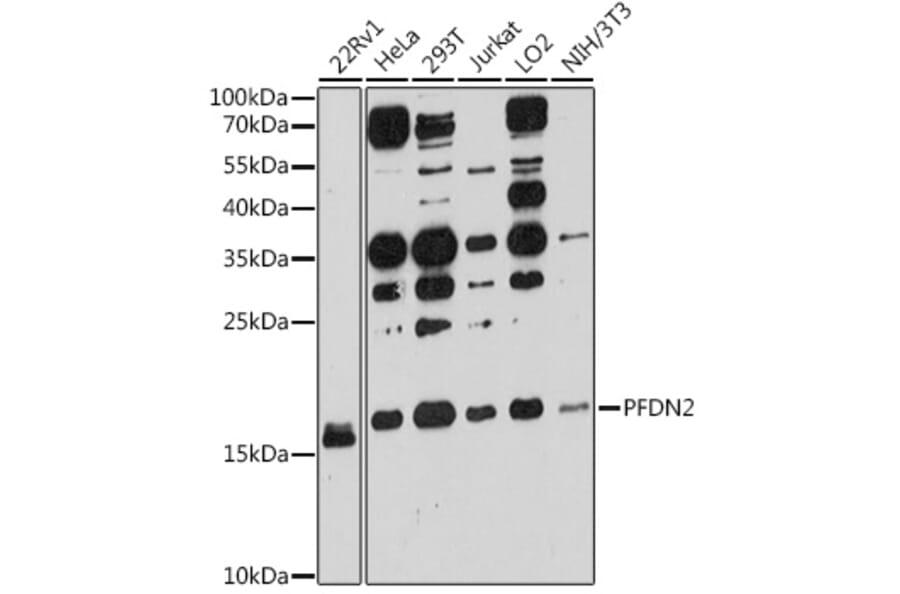 Western Blot - Anti-PFDN2 Antibody (A80983) - Antibodies.com