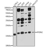 Western Blot - Anti-PFDN2 Antibody (A80983) - Antibodies.com