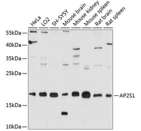 Western Blot - Anti-AP2S1 Antibody (A80984) - Antibodies.com