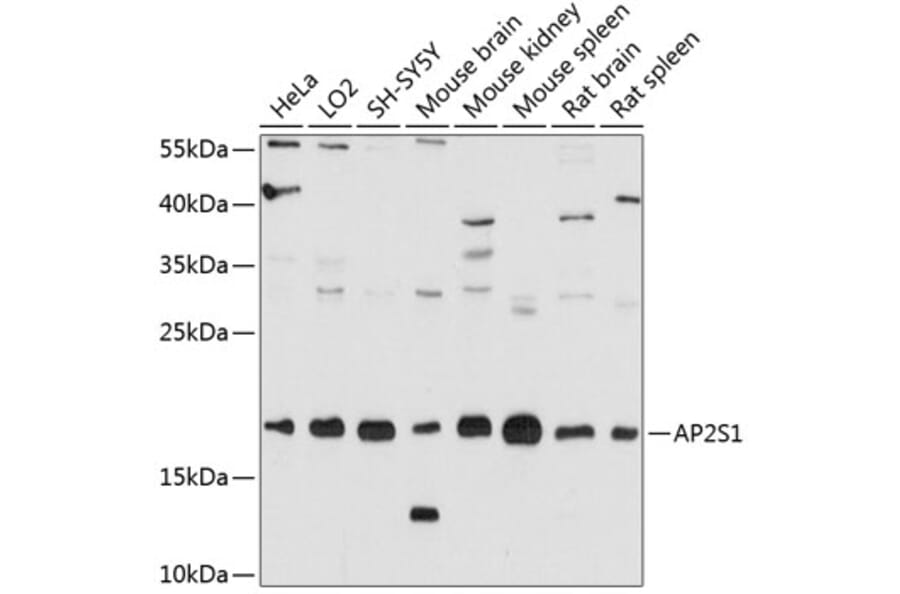 Western Blot - Anti-AP2S1 Antibody (A80984) - Antibodies.com