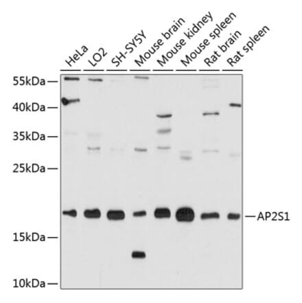 Western Blot - Anti-AP2S1 Antibody (A80984) - Antibodies.com