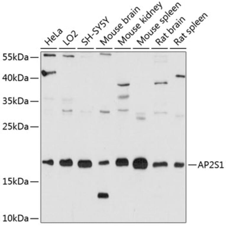 Western Blot - Anti-AP2S1 Antibody (A80984) - Antibodies.com