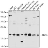 Western Blot - Anti-AP2S1 Antibody (A80984) - Antibodies.com