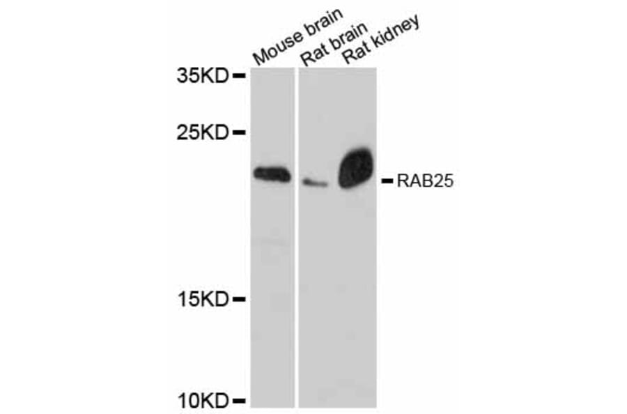 Western Blot - Anti-RAB25 Antibody (A12275) - Antibodies.com