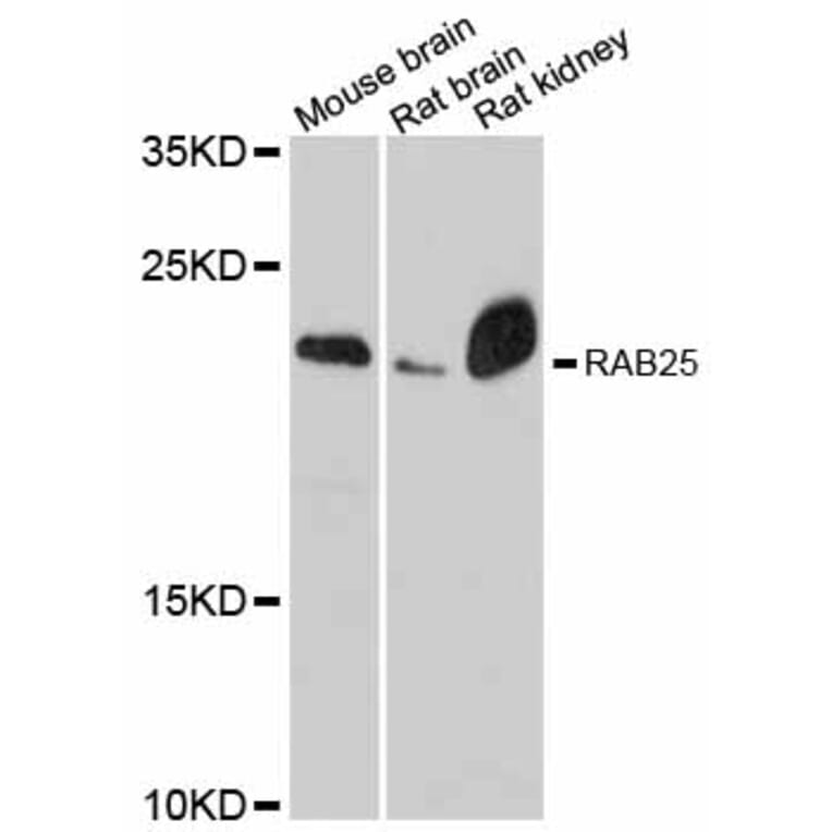 Western Blot - Anti-RAB25 Antibody (A12275) - Antibodies.com