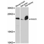 Western Blot - Anti-RAB25 Antibody (A12275) - Antibodies.com