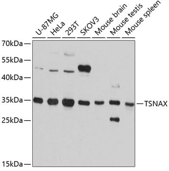 Western blot analysis of extracts of various cell lines, using Anti-TSNAX Antibody (A12276) at 1:3000 dilution.
Secondary antibody: Goat Anti-Rabbit IgG (H+L) (HRP) (AS014) at 1:10,000 dilution.
Lysates / proteins: 25µg per lane.
Blocking buffer: 3% non-fat dry milk in TBST.
Detection: ECL Basic Kit (RM00020).
Exposure time: 1s.