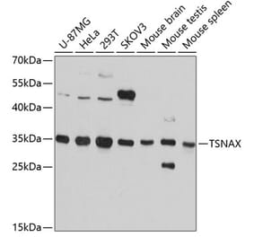 Western Blot - Anti-TRAX Antibody (A80986) - Antibodies.com