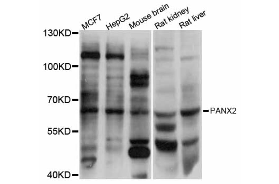 Western Blot - Anti-PANX2 Antibody (A12281) - Antibodies.com