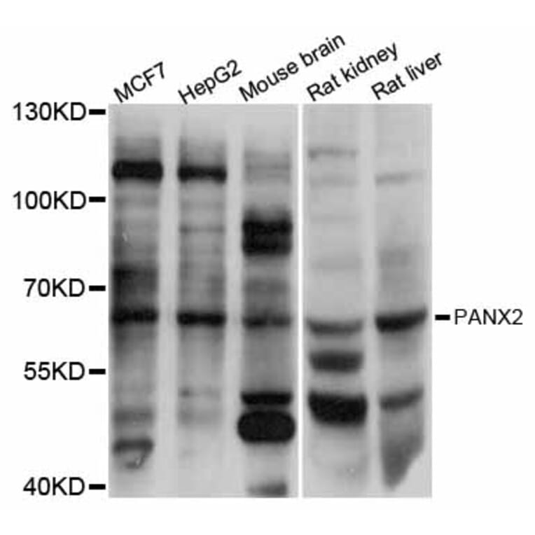 Western Blot - Anti-PANX2 Antibody (A12281) - Antibodies.com