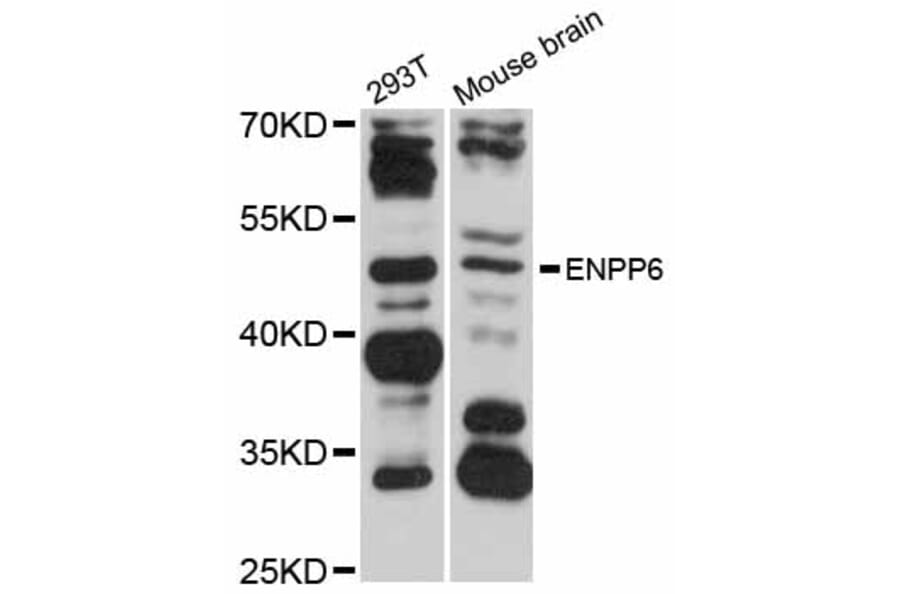 Western Blot - Anti-ENPP6 Antibody (A12290) - Antibodies.com