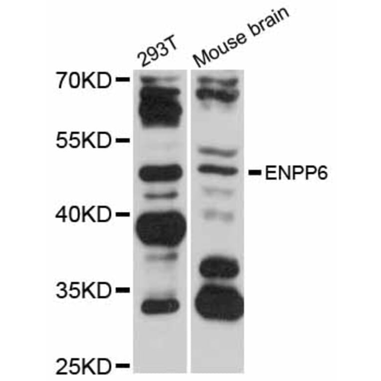 Western Blot - Anti-ENPP6 Antibody (A12290) - Antibodies.com