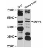 Western Blot - Anti-ENPP6 Antibody (A12290) - Antibodies.com