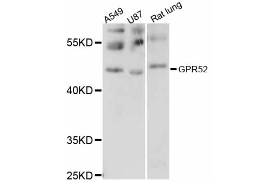 Western Blot - Anti-GPR52 Antibody (A12293) - Antibodies.com