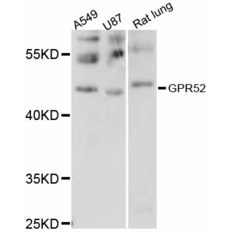 Western Blot - Anti-GPR52 Antibody (A12293) - Antibodies.com