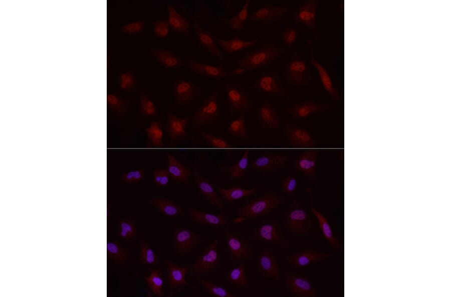 Immunofluorescence - Anti-MADH7/SMAD7 Antibody (A80992) - Antibodies.com