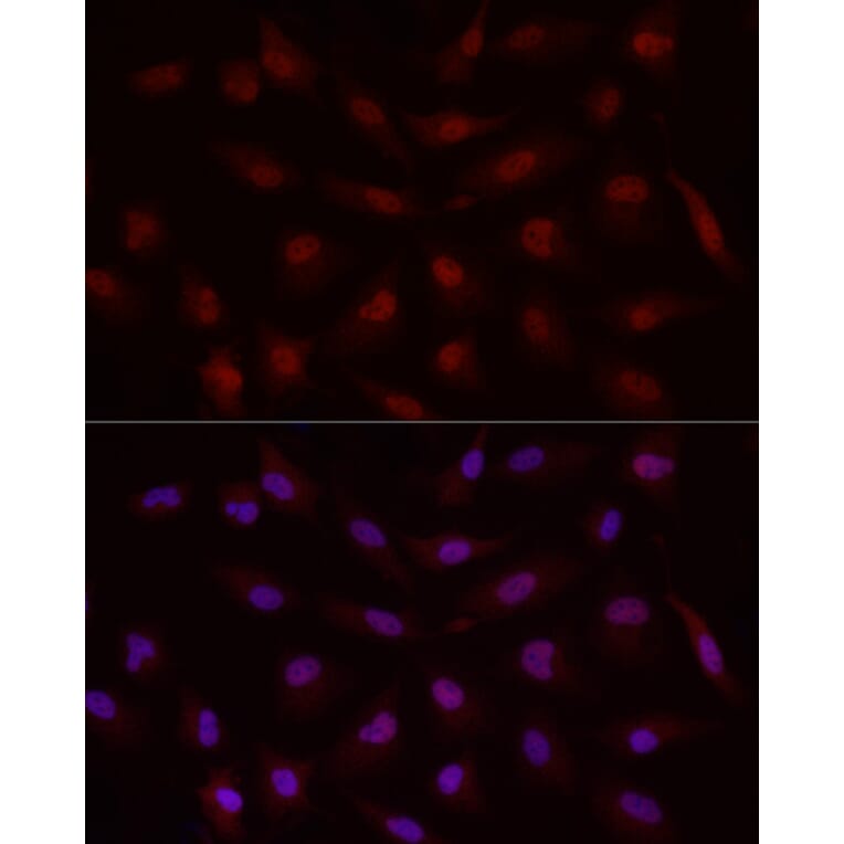 Immunofluorescence - Anti-MADH7/SMAD7 Antibody (A80992) - Antibodies.com