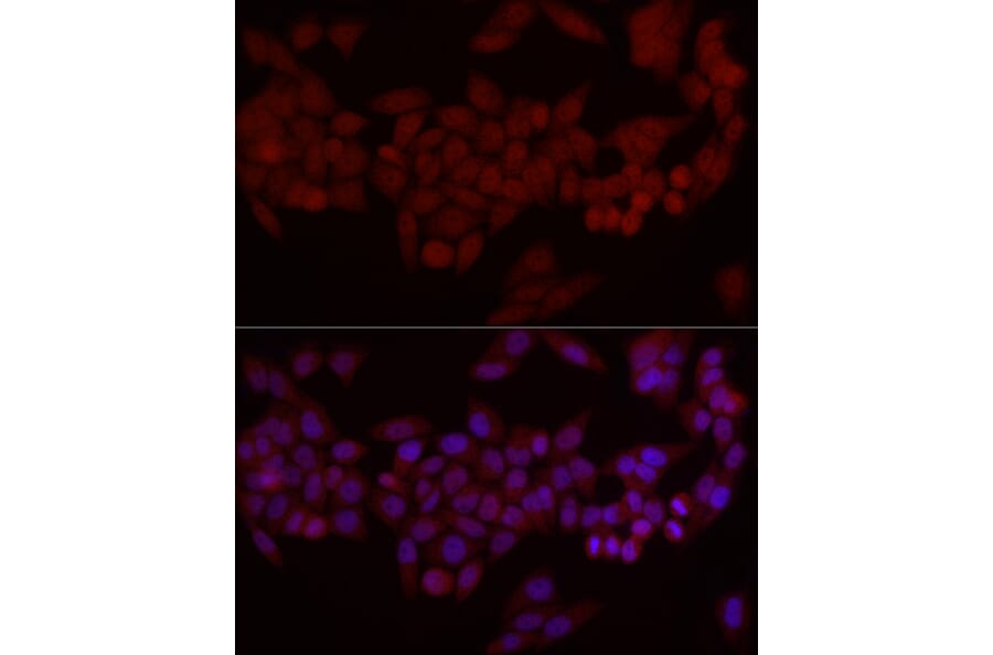Immunofluorescence - Anti-MADH7/SMAD7 Antibody (A80992) - Antibodies.com