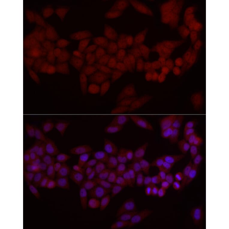 Immunofluorescence - Anti-MADH7/SMAD7 Antibody (A80992) - Antibodies.com